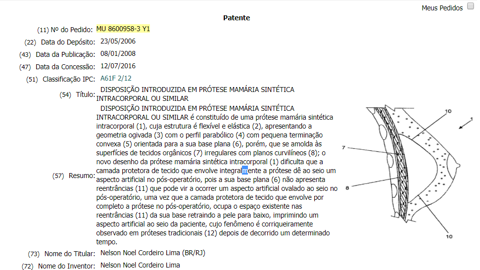 artigo imagem Ana Paula